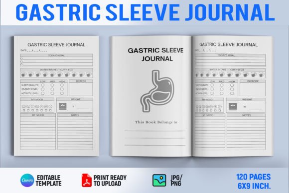 Gastric Sleeve Journal: A Comprehensive Guide to Enhancing Your KDP Publishing Journey